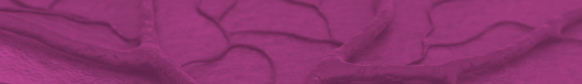 Angiologia e Cirurgia Vascular